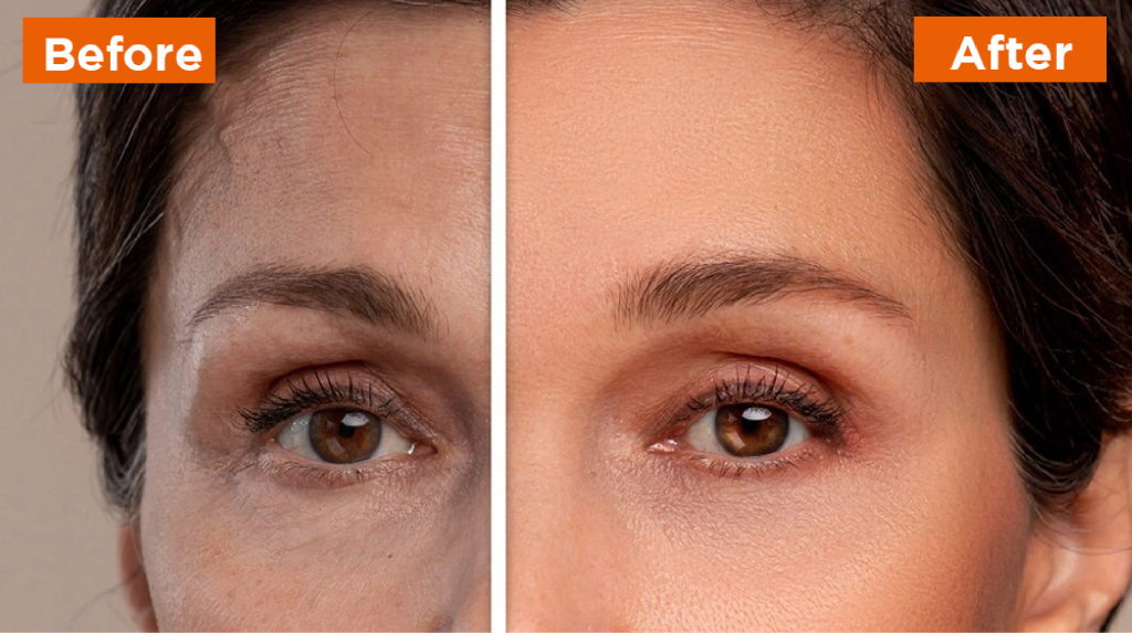 Why Professional Photo Retouching is Necessary: Essential Tools and Services Beauty Retouching